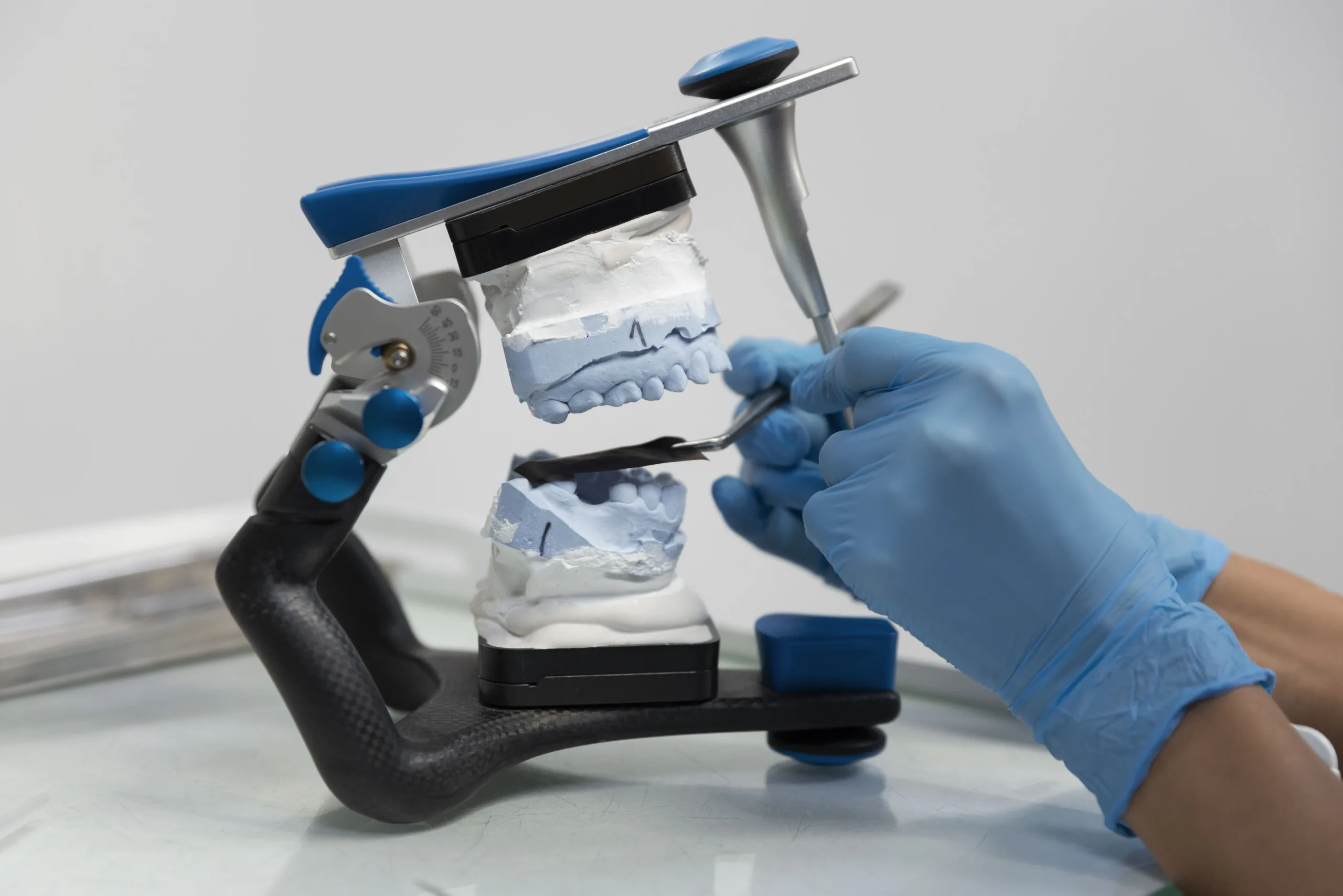 Diagnóstico Preciso En Odontología Mediante El Uso Del Articulador eddy muriel ortodoncia